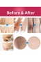 Anti-Darkening Skin Whitening Cream 1 Piece - 5