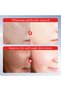 Kojic Acid Whitening Freckles Removal Toner Korean Skin Care Brightening Fade Dark Spots Face Tone - 4