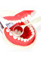 10pcs/Box Dental Double Sided Mouth Mirrors With Handle Random Colors Autoclavable Surface Exam R... - 6