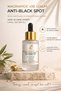 Niacinamide 10% Serum – Anti-Blemish, Blackhead and Anti-Acne Skin Care Serum