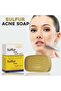 Sulfur Soap, 80g - Pack of 3 - 2