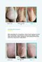 Smooth & Pure Softening Foot Peeling Mask Sheet - Sock Type Skin Softening Foot Peeling Mask - 6