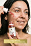 Aha Bha Revitalizing and Skin Tone Equalizing Red Peeling Skin Serum - 3
