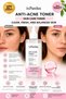 Salicylic Acid Anti-Acne Tonic 200 ml |   Sebum Balancing Facial Tonic Containing Niacinamide & Aha Pha - 4