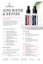 SER ACNEE ACNE BUSTER - 3