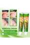 Professional-Grade Corn and Callus Remover for Home Use - 7