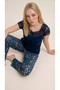 Petrol Lace Collar Detailed Viscose Short Sleeve Pajama Set - 2