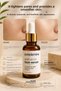 Serena Anti-Acne Face Serum Maintains the Oil Balance on Your Skin and Reduces Acne Formation. - 6