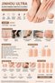 Jinhou Ultra Silicone Toe/Hand Finger Protector & Separator – Perforated Breathable Soft Gel Finger Sleeve |   Washable Again and Again |   8 Pieces (S: 4, M: 4) |   Skin Color