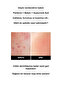 Soothing Cica Stem Cell Exosome Ampoule - 4
