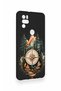 Omix X300 Compatible Compass Forest Patterned Silicone Case - 3