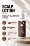 Anti Dandruff Shampoo (Dandruff Hair) + Scalp Lotion - 5