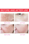 Whitening Repair Pigmentation Serum, Melasma Brightening, Dark Spots, Anti-Aging, Melasma Removal - 3
