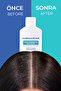 Anti-Dandruff Shampoo - Anti-Dandruff Shampoo 120 ml - Climbazole & Piroctone - 6