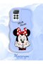 Redmi Note 11 Pro 4g Compatible Case Camera Protector Blue Silicone Couple Phone Case Cute Pattern - 2