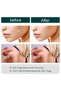 Skin Tag Remover Patches Mole Wart Removing Sticker Natural Ingredients 120 Pieces - 4