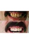 Teeth Whitening and Tartar Removal 10 ml Economical (1 Piece) - 3