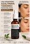 Hybrid Peel Lactic Acid 30% + Salicylic Acid 10% Professional Chemical Peeling Solution |   Aha Bha Peeling That Helps Reduce the Appearance of Blemishes, Refine Pores, and Even Out Skin Tone. - 4