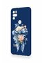Omix X300 Compatible Blue Ribbon Flower Patterned Silicone Case - 3