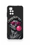 Redmi 10 2022 Compatible Pop David Patterned Silicone Case - 2