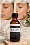 30% Glycolic Acid Peeling - Powerful Glycolic Acid Peeling That Brings the Professional Skin Care Effect to the Comfort of Your Home. - 3