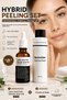 Professional Chemical Peeling Set Hybrid Peel 10% Lactic Acid 10% Salicylic Acid + Neutralizer |   Blackhead, Pore and Skin Tone Equalizing Care - 2