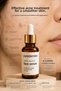 Serena Anti-Acne Face Serum Maintains the Oil Balance on Your Skin and Reduces Acne Formation. - 5