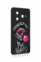 Tecno Camon 30 Pro 5g Compatible Pop David Patterned Silicone Case - 3