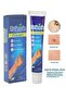 Urticaria Cream Ointment for Allergic Reactions, Skin Rash Relief, Redness Reduction, Care