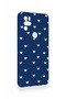 Omix X300 Compatible Mini White Heart Navy Blue Patterned Silicone Case - 4