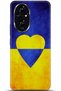 Honor 200 Case Hd Printed Case - They Can'T Bring Me down 5581