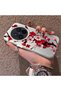 Vivo X300 Pro Compatible Silicone Edge Hard Back Case Couple Phone Case with Floral Pattern - 2