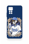 Redmi Note 11 Pro 4g Compatible Royals Patterned Silicone Case - 2