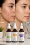 Hyaluronic Acid + Vitamin C + Retinol Serum 3-Pack – Professional Skincare to Help Reduce the Appearance of Blemishes, Brighten Skin, Hydrate, and Support Fine Lines