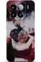 Xiaomi Mi 15 Case Hd Printed Case - They Can'T Bring Me down 6053