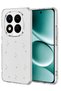 Xiaomi Redmi Note 15 Pro Plus 5g Compatible Bow Patterned Cover - Pattern 4
