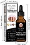 Toenail Fungus Treatment Extra Strength–Nail Fungal Oil with Glycerin & Panthenol-50ml - 2