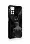 Redmi Note 11S Compatible Icarus Patterned Silicone Case - 3