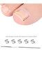 Ingrown Toenail Corrector Pedicure Recover Embed Toe Nail Treatment Professional Foot Correction ... - 8