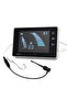 whole set Dental Endo Apex Locator Dentistry Endodontics Root Canal Measurement Mini Root Canal Loca - 4
