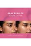 Advanced COLLAGEN BOOST Brightening Day Cream SPF 25 with Hyaluronic Acid | Anti-Ageing Moisturiser for Fine Lines, Dark Spots, Hydration & Radiant Skin | 50ml - 5