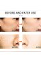 Dr Hancy White Spot Cream Set (3pcs) Dark Spot Corrector for Dry & Sensitive Skin - 3