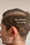 Gr-7 Hair Lotion for White Hair Offering Natural Solution for White Hair 125 ml - 5