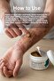 Nosca Double Effect Cream (Itching) 150 ml - 4