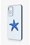 Redmi Note 11 Pro 4g Compatible Blue Starfish Patterned Silicone Case - 3