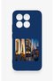 Mi 15t 5g Compatible Paris Patterned Silicone Case - 2