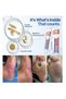 Sugar Guard Recovery Cream For Diabetic Skin,Helps Repair Cracked Heels,Relieves Dryness and Itching - 6