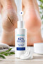 Intensive Care for Cracked, Dry, and Hardened Heels: a Softer and Smoother Heel Appearance with 42% Urea and 2% Salicylic Acid - 6