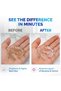 120 Retainer & Denture Cleaning Tablets - Remove Plaque, Odors, Stains - 3