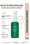 Niacinamide Serum Anti-Acne Blackhead 2-Pack Skin Care Set Roller - 2